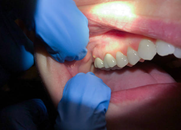 Best Emergency Dental Surgery in Highland Park, MI