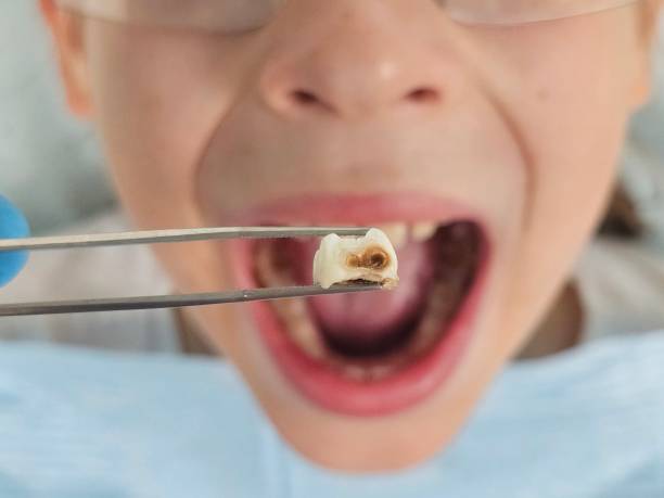Best Emergency Treatment for Toothache in Highland Park, MI
